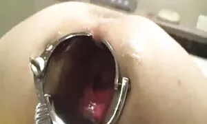 Anal, lehibe sy feno ...