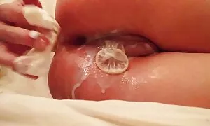 Anal feno misy tsiri ...